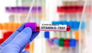 Vitamin D Test: Complete Guide to Levels, Reports & Normal Range